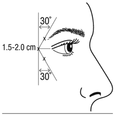 botulinum02.gif
