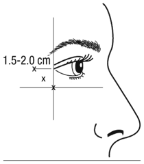 botulinum03.gif